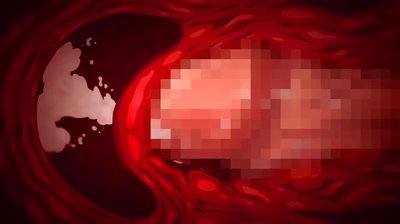 Thumbnail of post image 037